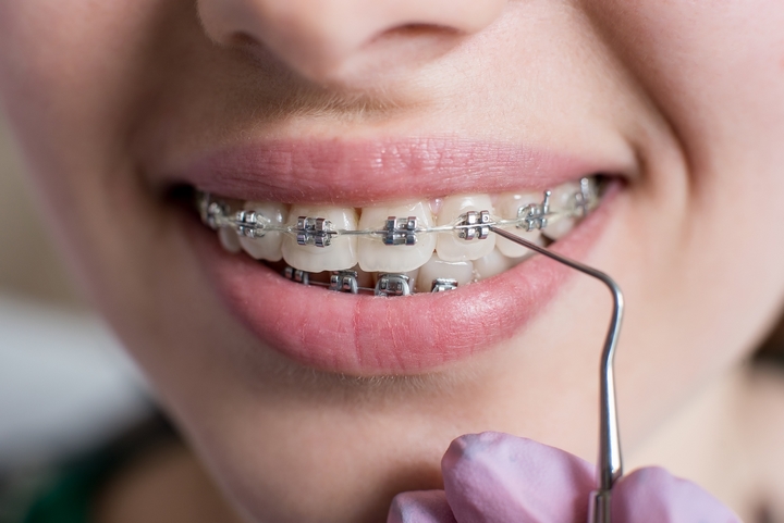 The 4 Guidelines to Orthodontists